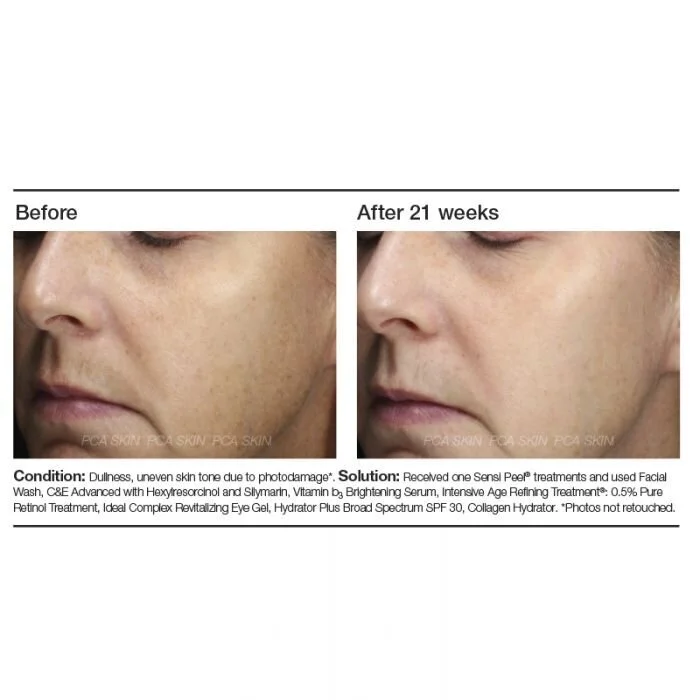 Win　サイン　ULTlMUNE brightwin Sweets & Candy Starry Sky Usakumya OP by Baby, the Stars